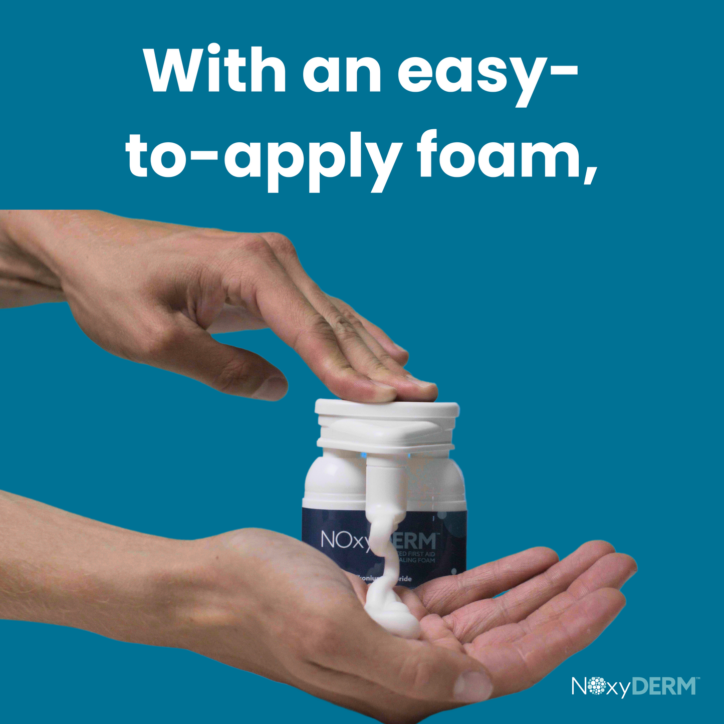 Hands using NOxyDERM™ foam for easy application on minor wounds, showcasing premium wound care treatment.