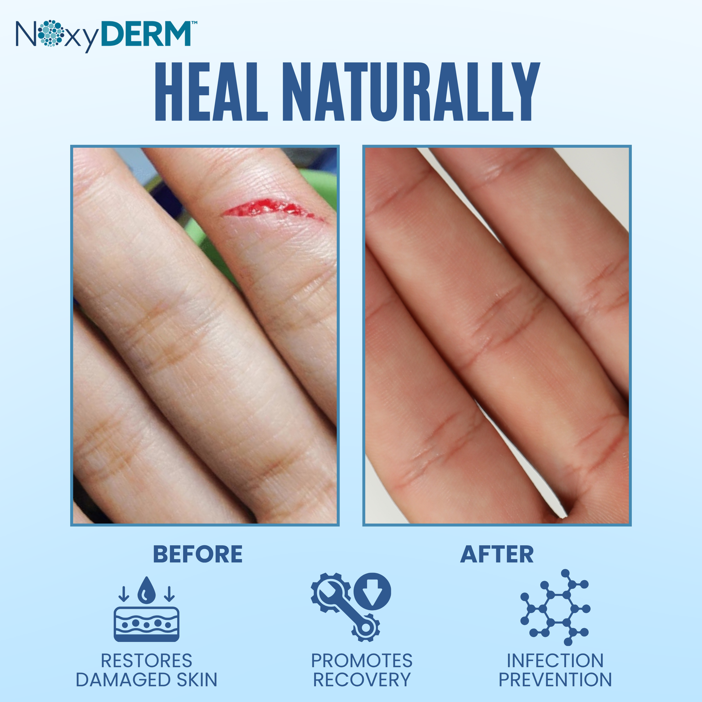 NOxyDERM Wound Care Foam | 1oz