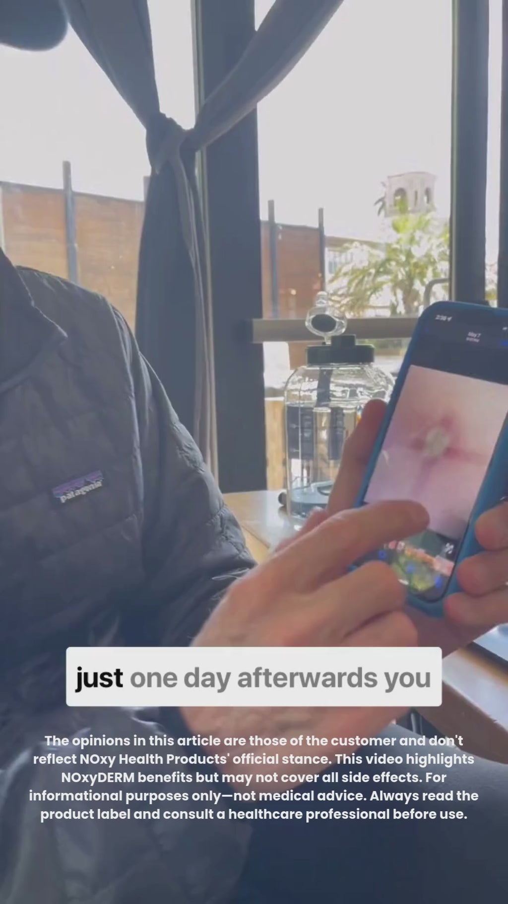 NOxyDERM Wound Care Foam | 1oz