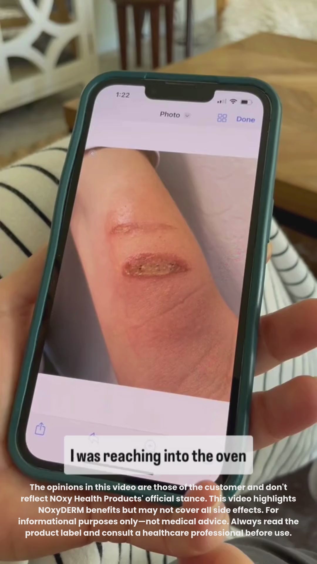 NOxyDERM Wound Care Foam | 1oz